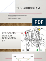 Electrocardiogram A: Brenda Jacqueline Castillo Hernández R1 Anestesiología Hospital General de Zona 14