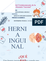 Hernia Inguinal