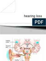 hearing-loss.pptx
