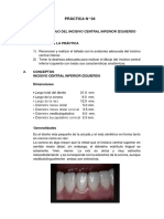 Práctica #4 Tallado Del Incisivo Central Inferior Izquierdo