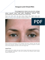 Seputar Ptosis