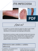 Celulitis Infecciosa