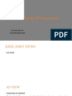 Positioning of Knee Joint: DR Munazzah Rao PGT MD Radiology