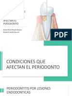 Periodoncia Lesiones