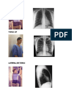 POSICIONES Radiografías