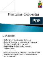 Fracturas Expuestas