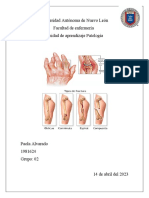 Artritis Reumatoide y Fractura