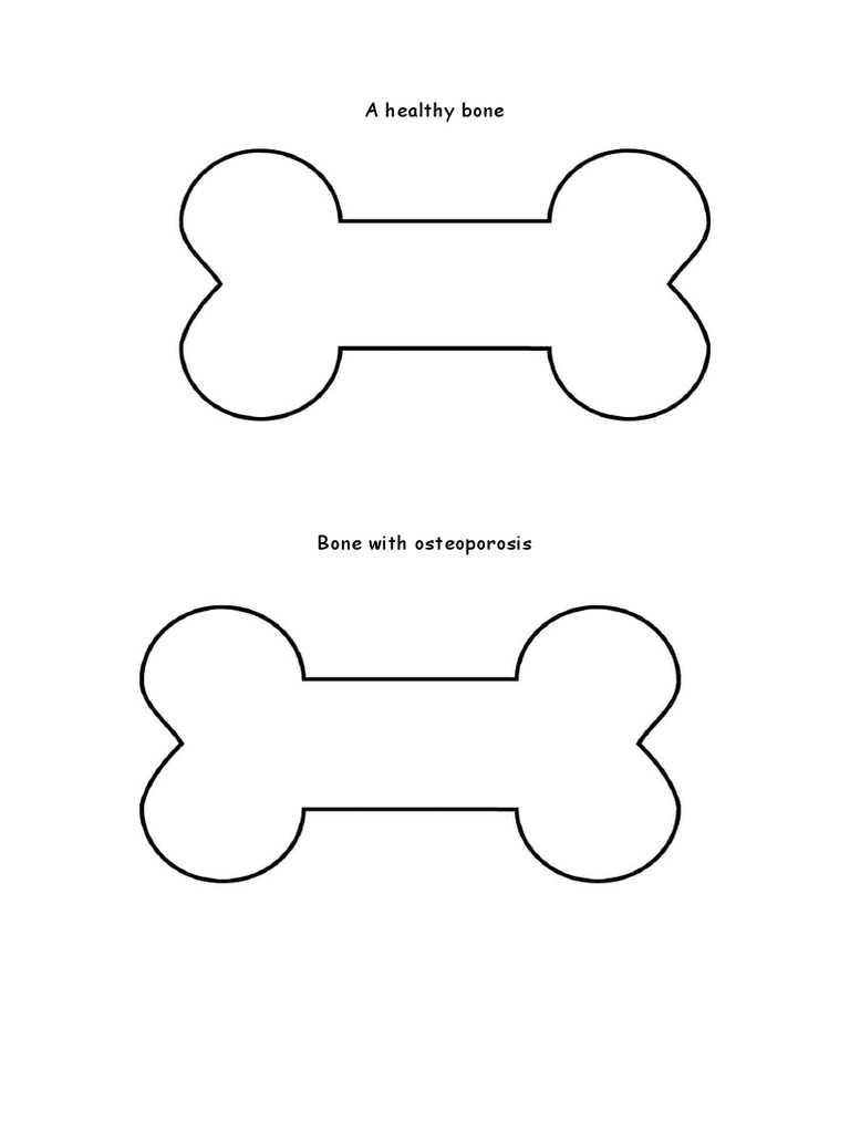 brittle bone activity PDF