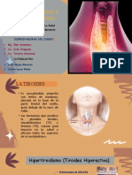 Hipotiroidismo y hipertiroidismo: causas, síntomas y cuidados