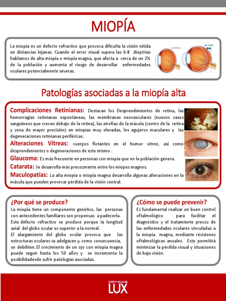 Miopia | PDF | Ciencia y matemáticas