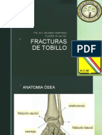 Fracturas de Tobillo