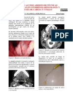 Exeresis de Ranula y Glándula Sublingual