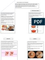 Infecciones de Vias Urinarias