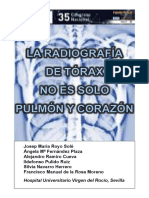 RX de Tórax No Solo Pulmón y Corazón