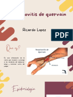 Quervain