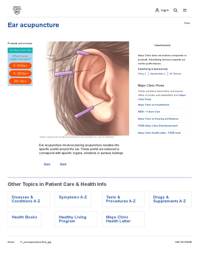 Ear Acupuncture Mayo Clinic PDF Clinical Medicine Social Programs