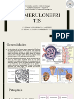 Glomerulonefritis Final