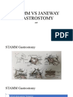 Stamm Vs Janeway Gastrostomy