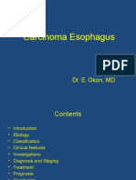 Esophageal CA