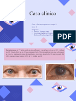 GLaucoma