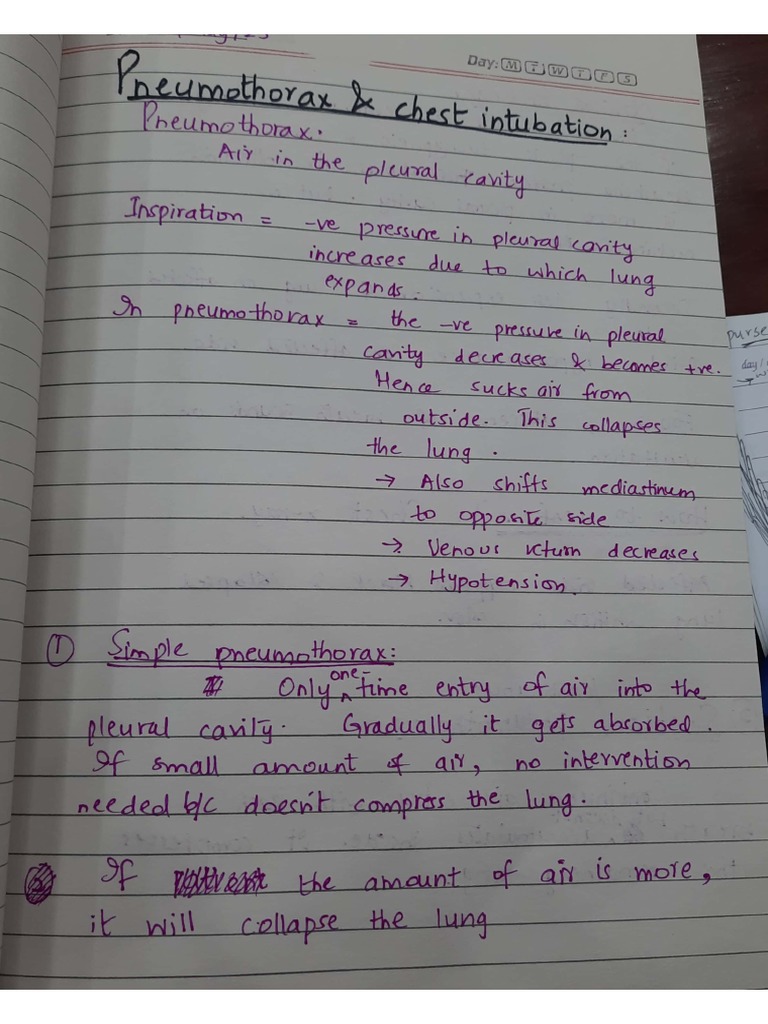 Surgery Pneumothorax and Chest Intubation PDF