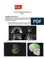 Anatomía Normal en CBCT