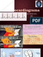 Electrocardiograma