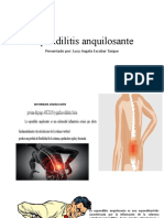 Espondilitis Anquilosante