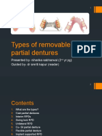 Types of Removable Partial Dentures New