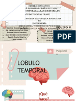 Lóbulo Temporal.