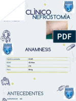 Caso Clinico Nefrostomia