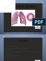 Cancer en El Pulmones