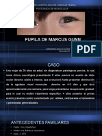 Pupila de Marcus Gunn