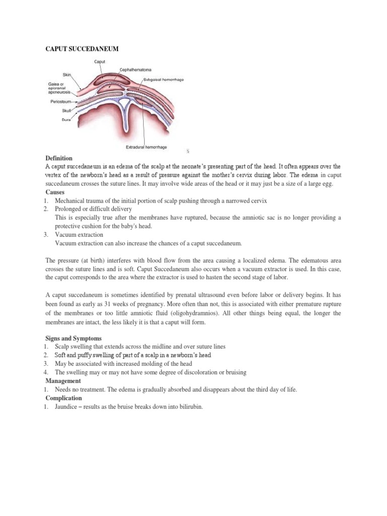 Caput Succedaneum