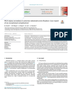 PICA Injury Secondary To Anterior Odontoid Screw Fixation