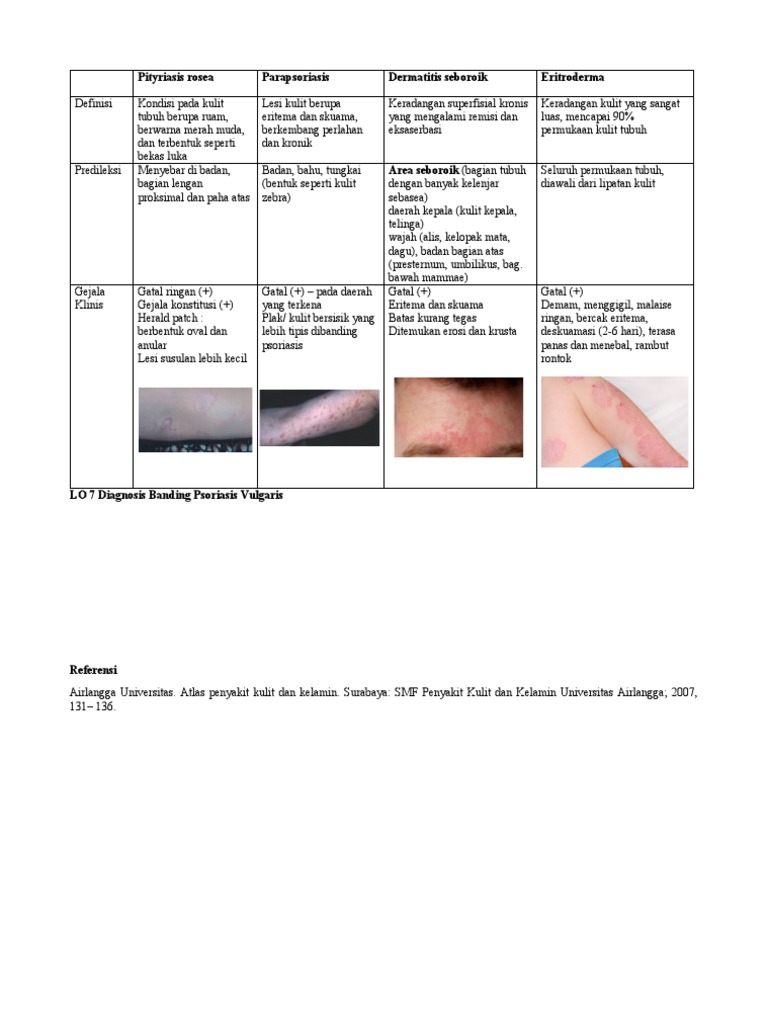 LO 7 Diagnosis Banding Psoriasis Vulgaris PDF