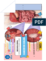 Historia Clinica Cancer de Colon-Alumna Morales Matamoros Yamilet