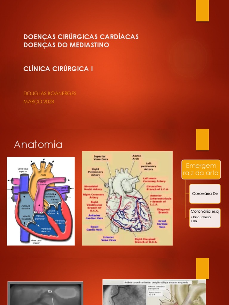 CIRURGIA 22 Cirurgia Cardíaca Mediastino PDF Coração Cirurgia de revascularização