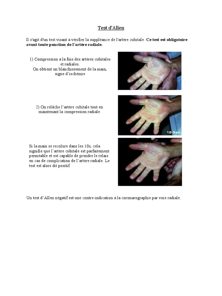 Test d'Allen : Vérification Artérielle | PDF