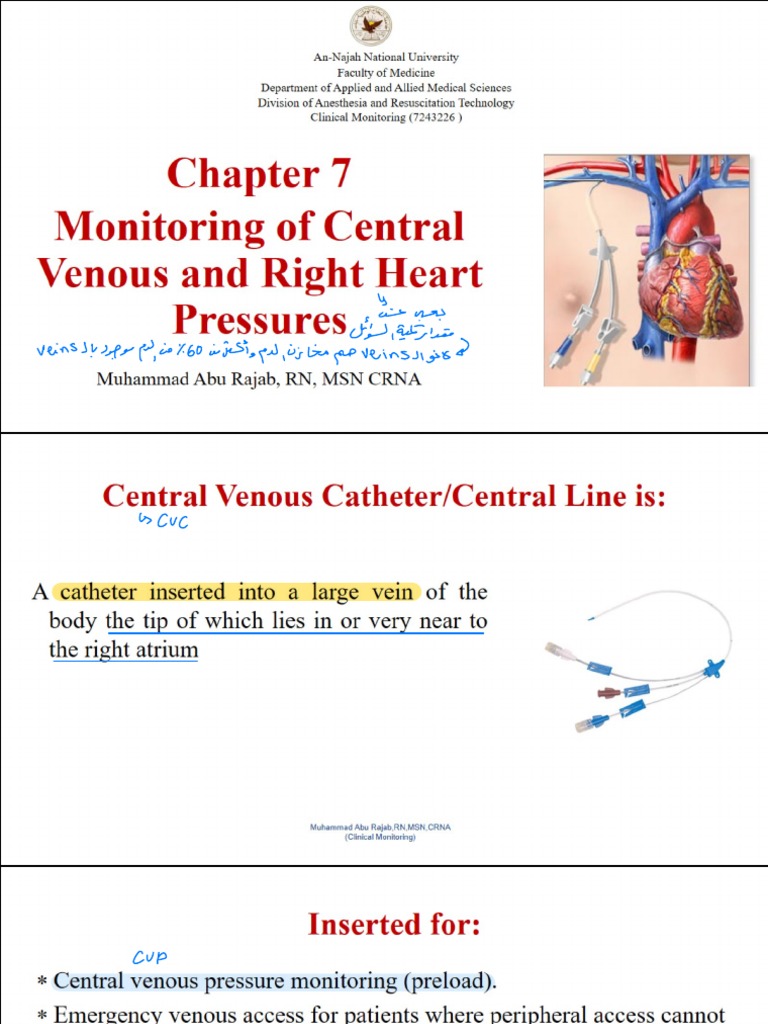 Central Venous Pressure Monitoring – KTKXNE