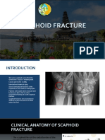 Scpahoid Fracture