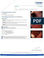 Videoendoscopia Digestiva Alta