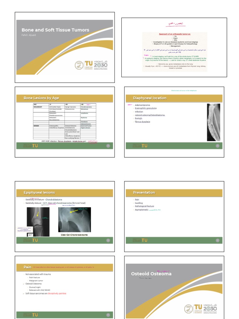 18 - Management of Bone and Soft Tissue Tumors 2 | PDF | Metastasis ...