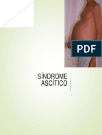 Sindrome Ascitico
