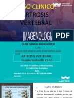Caso Clinico Artrosis Columna Vertebral