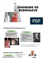 Síndrome de Boerhaave