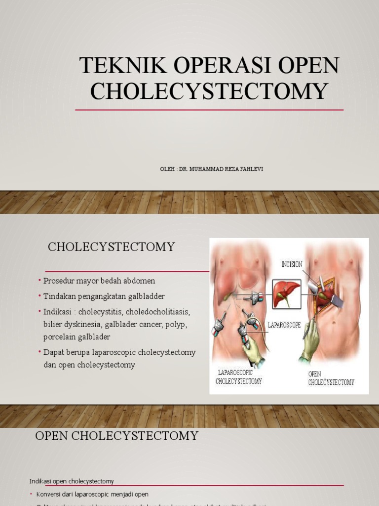 To Open Cholecystectomy | PDF | Sains & Matematika