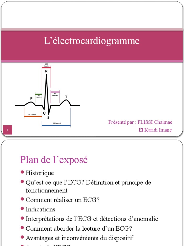 Lecture et Interprétation de l'ECG | PDF | Électrocardiographie | Thorax