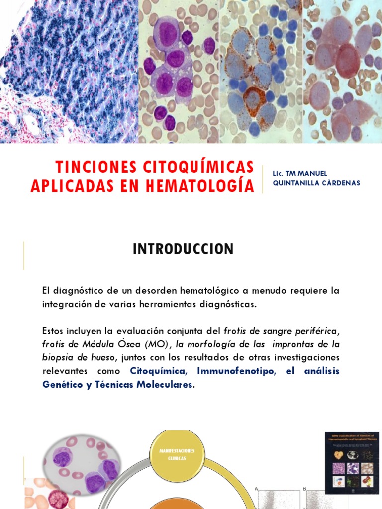 t-cnicas-citoqu-micas-en-hematolog-a-pdf-leucemia-tinci-n