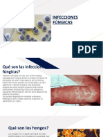 Infecciones Fúngicas